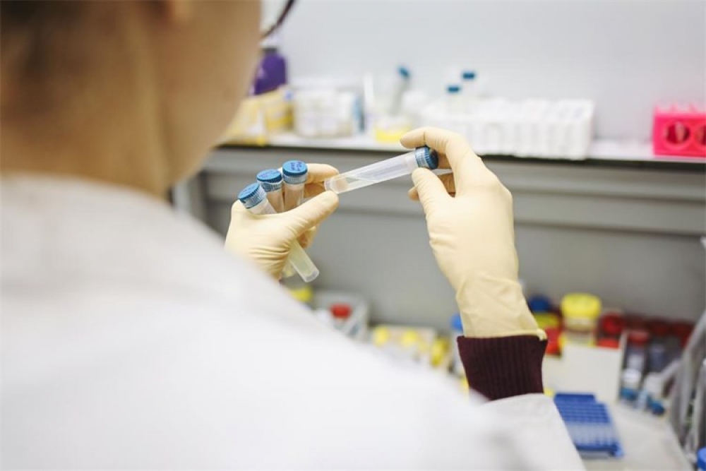U posljednja 24 sata 4986 testiranja - 388 novih slučajeva zaraze, na respiratoru 73 pacijenta, preminulo 8 osoba